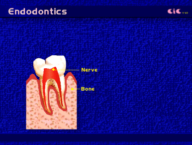 endod1